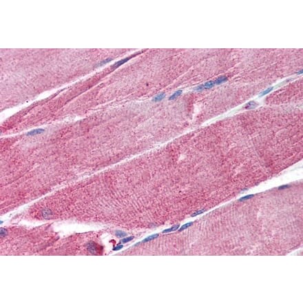 Immunohistochemistry - Anti-MURF1 Antibody (A84157) - Antibodies.com