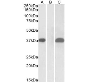 Western Blot - Anti-PIM2 Antibody (A84158) - Antibodies.com