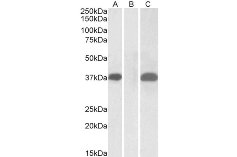 Western Blot - Anti-PIM2 Antibody (A84158) - Antibodies.com