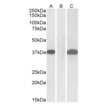 Western Blot - Anti-PIM2 Antibody (A84158) - Antibodies.com