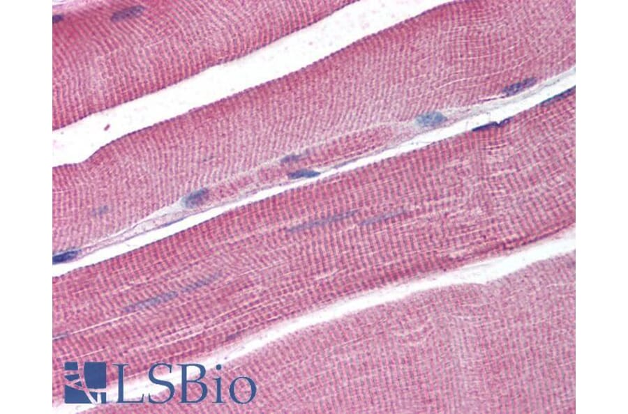 Immunohistochemistry - Anti-SNM1A Antibody (A84159) - Antibodies.com