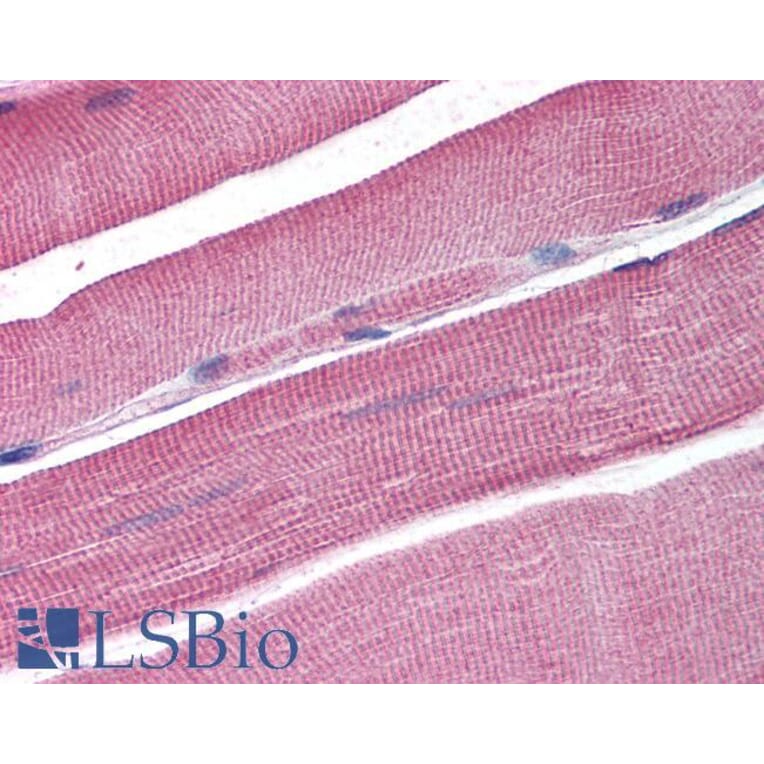 Immunohistochemistry - Anti-SNM1A Antibody (A84159) - Antibodies.com