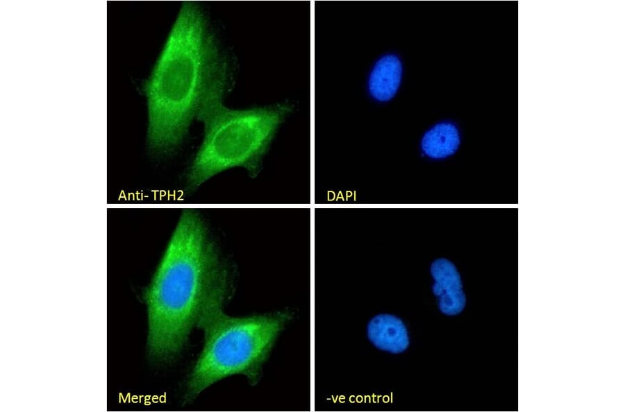 Immunofluorescence - Anti-TPH2 Antibody (A84160) - Antibodies.com