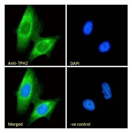 Immunofluorescence - Anti-TPH2 Antibody (A84160) - Antibodies.com