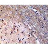 Immunohistochemistry - Anti-TPH2 Antibody (A84160) - Antibodies.com