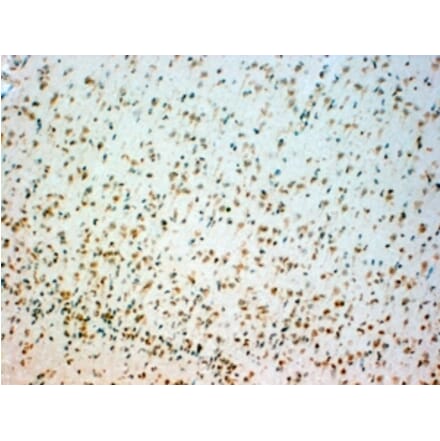 Immunohistochemistry - Anti-TPH2 Antibody (A84160)