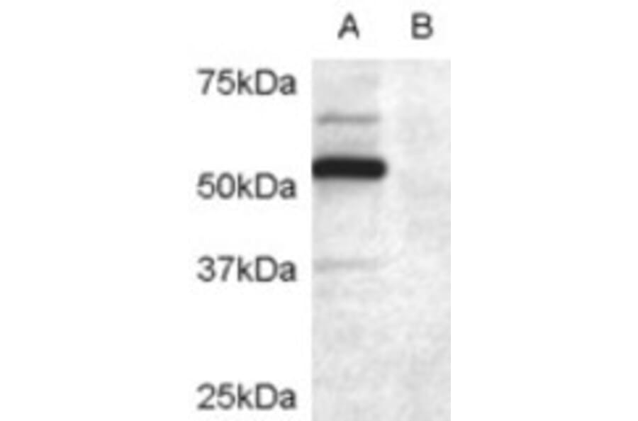 Western Blot - Anti-DCDC2/RU2 Antibody (A84162) - Antibodies.com