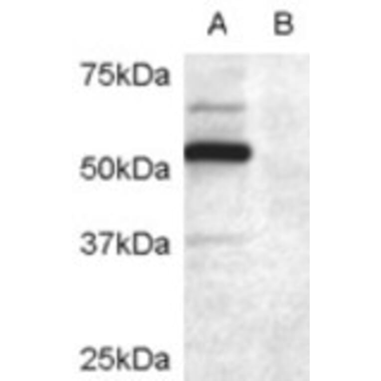 Western Blot - Anti-DCDC2/RU2 Antibody (A84162) - Antibodies.com