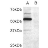 Western Blot - Anti-DCDC2/RU2 Antibody (A84162) - Antibodies.com