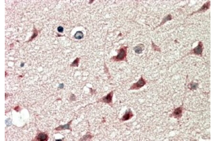 Immunohistochemistry - Anti-DCDC2/RU2 Antibody (A84162) - Antibodies.com