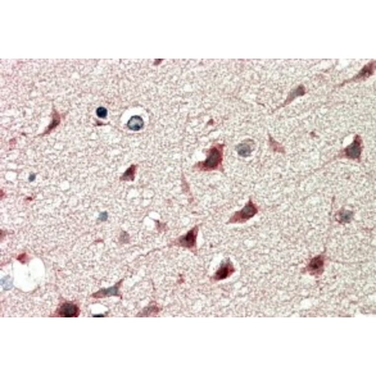 Immunohistochemistry - Anti-DCDC2/RU2 Antibody (A84162) - Antibodies.com