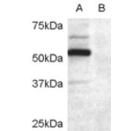 Western Blot - Anti-DCDC2 Antibody (A84162) - Antibodies.com