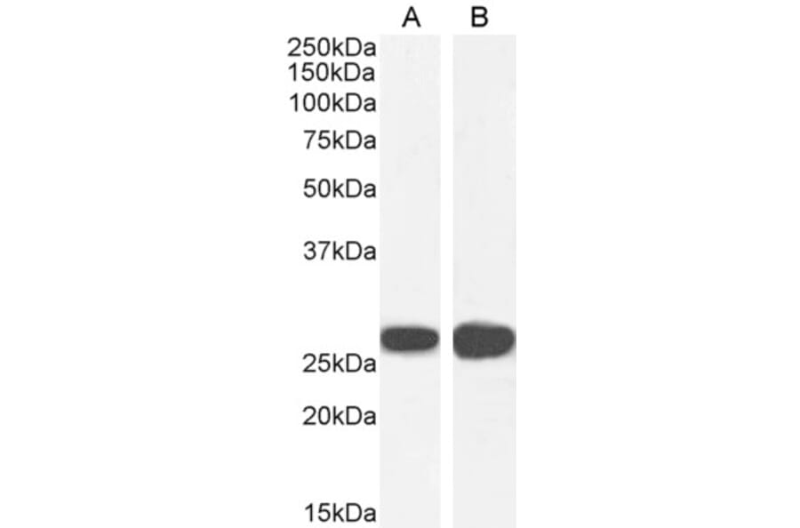 Western Blot - Anti-14-3-3 sigma/SFN Antibody (A84164) - Antibodies.com