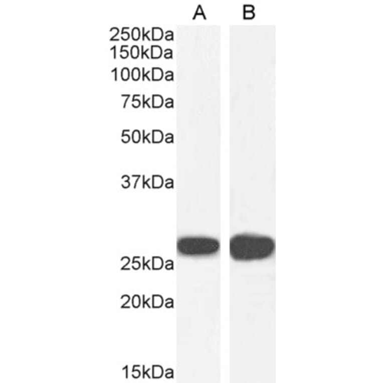 Western Blot - Anti-14-3-3 sigma/SFN Antibody (A84164) - Antibodies.com