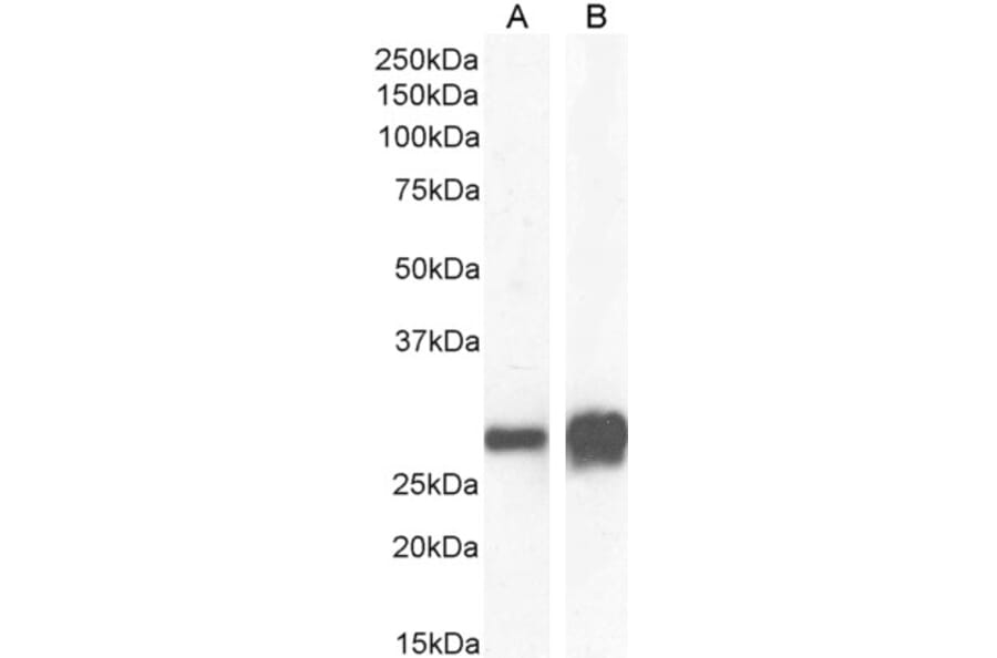 Western Blot - Anti-14-3-3 sigma/SFN Antibody (A84164) - Antibodies.com