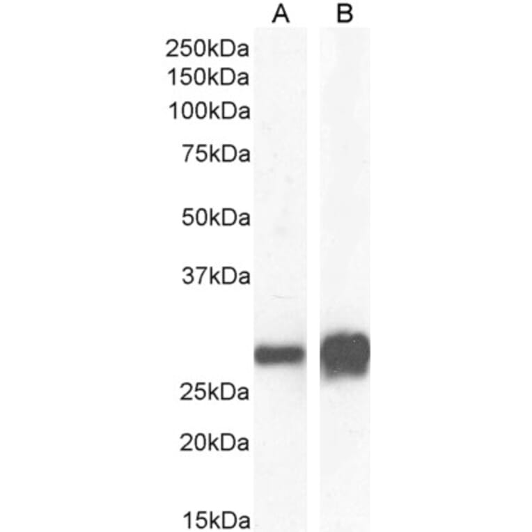 Western Blot - Anti-14-3-3 sigma/SFN Antibody (A84164) - Antibodies.com