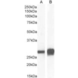 Western Blot - Anti-14-3-3 sigma/SFN Antibody (A84164) - Antibodies.com