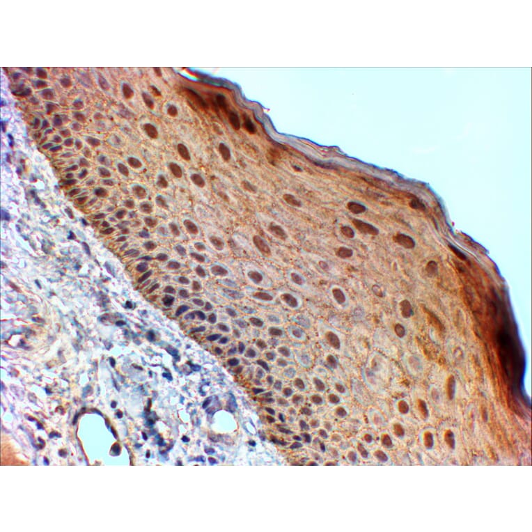 Immunohistochemistry - Anti-14-3-3 sigma/SFN Antibody (A84164) - Antibodies.com