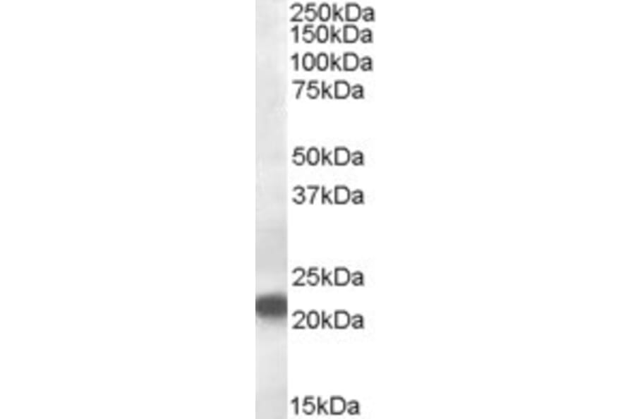 Western Blot - Anti-VPS25 Antibody (A84166) - Antibodies.com