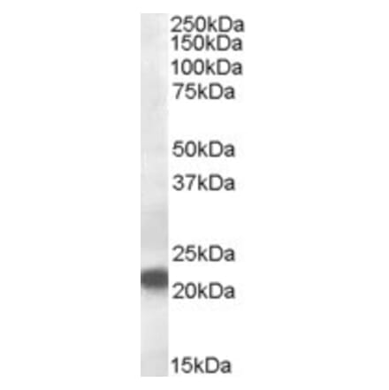 Western Blot - Anti-VPS25 Antibody (A84166) - Antibodies.com