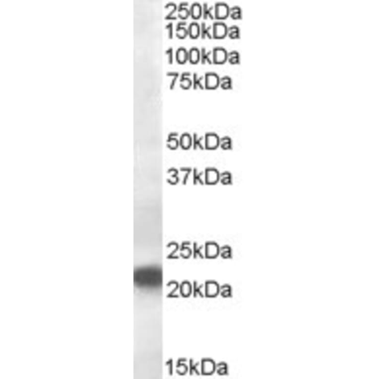 Western Blot - Anti-VPS25 Antibody (A84166) - Antibodies.com