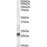 Western Blot - Anti-VPS25 Antibody (A84166) - Antibodies.com