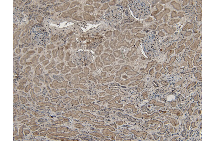 Immunohistochemistry - Anti-VPS25 Antibody (A84166) - Antibodies.com