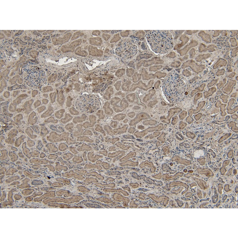 Immunohistochemistry - Anti-VPS25 Antibody (A84166) - Antibodies.com