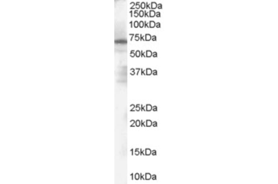 Western Blot - Anti-PARP2 Antibody (A84168) - Antibodies.com