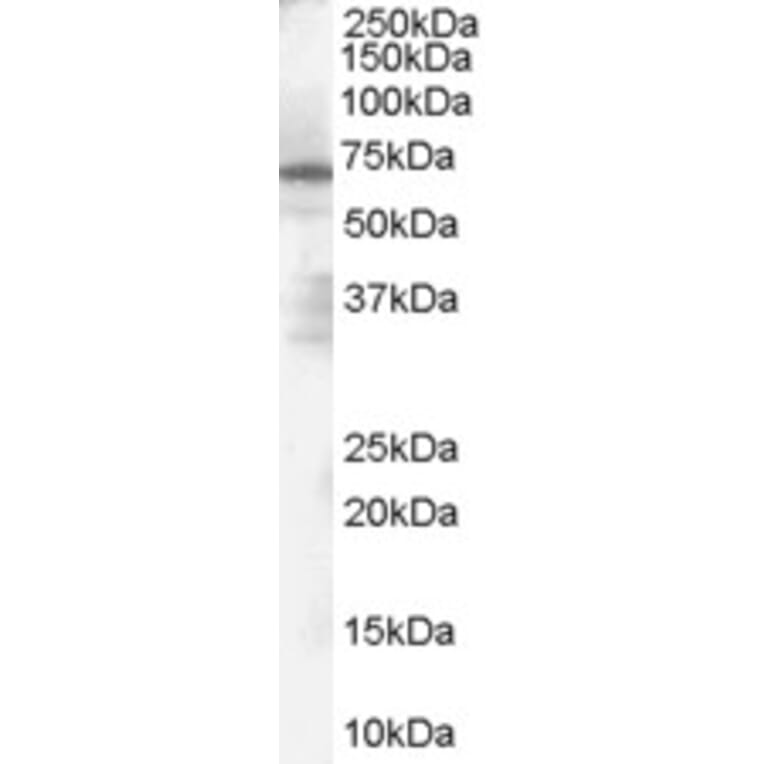 Western Blot - Anti-PARP2 Antibody (A84168) - Antibodies.com