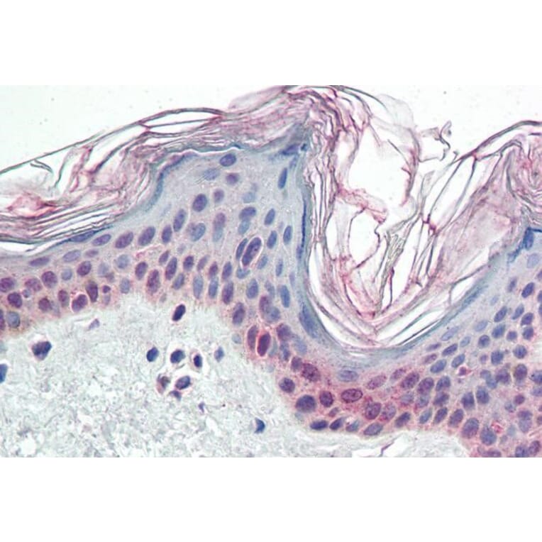 Immunohistochemistry - Anti-PARP2 Antibody (A84168) - Antibodies.com