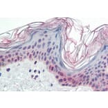 Immunohistochemistry - Anti-PARP2 Antibody (A84168) - Antibodies.com