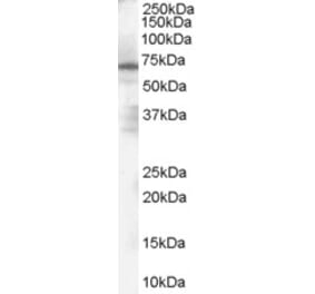Western Blot - Anti-PARP2 Antibody (A84168) - Antibodies.com