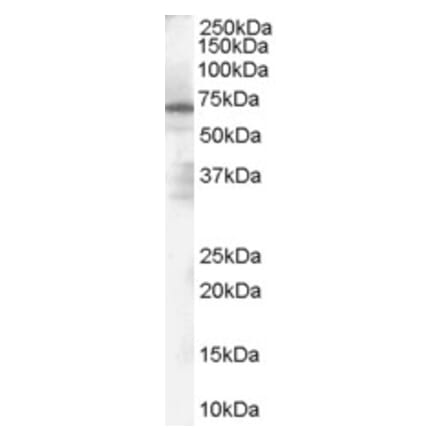 Western Blot - Anti-PARP2 Antibody (A84168) - Antibodies.com
