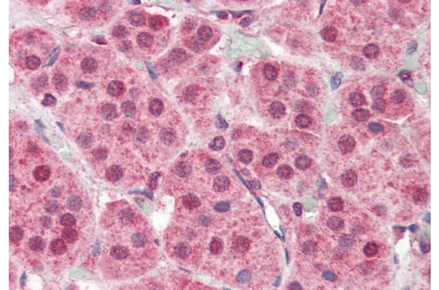 Immunohistochemistry - Anti-PARP2 Antibody (A84168) - Antibodies.com