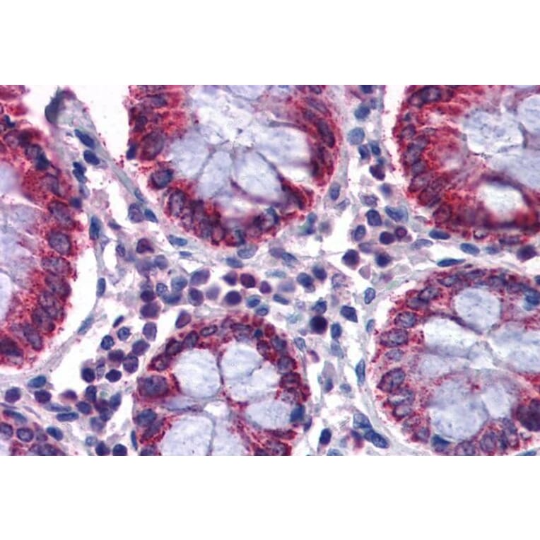 Immunohistochemistry - Anti-SCD1 Antibody (A84171) - Antibodies.com