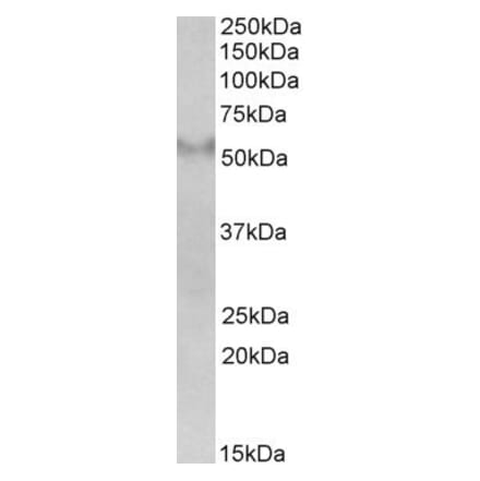 Western Blot - Anti-FSD1 Antibody (A84172) - Antibodies.com