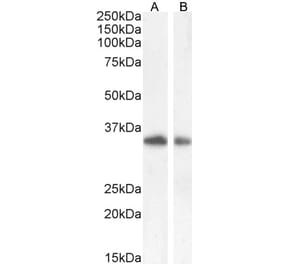 Western Blot - Anti-TIM 3 Antibody (A84174) - Antibodies.com