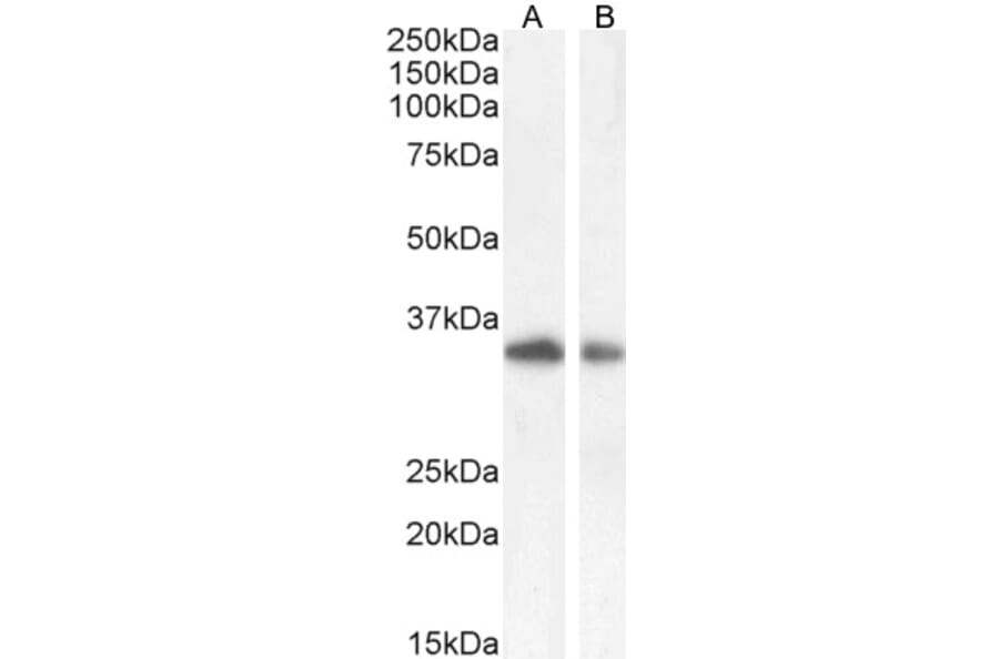 Western Blot - Anti-TIM 3 Antibody (A84174) - Antibodies.com