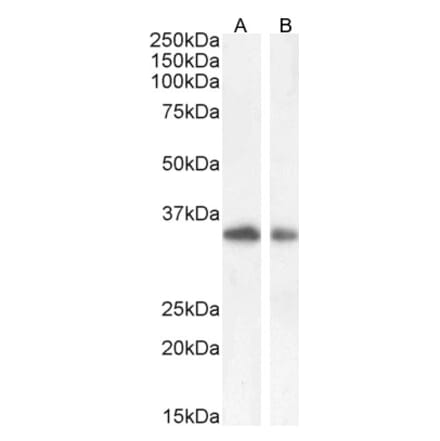 Western Blot - Anti-TIM 3 Antibody (A84174) - Antibodies.com