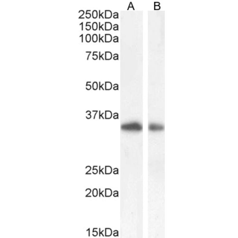 Western Blot - Anti-TIM 3 Antibody (A84174) - Antibodies.com