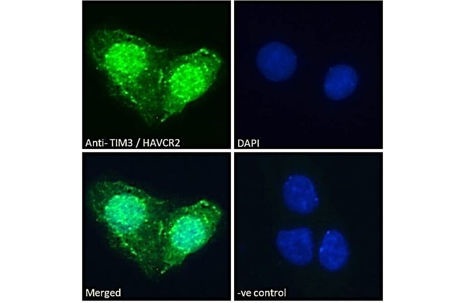 Immunofluorescence - Anti-TIM 3 Antibody (A84174) - Antibodies.com