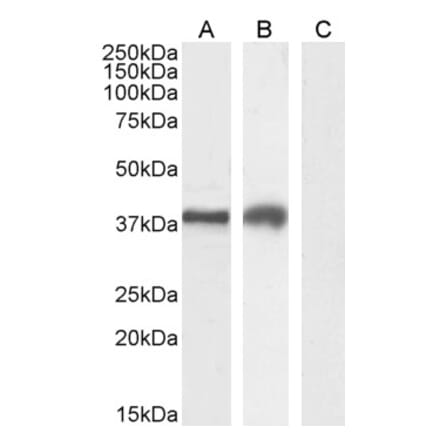 Western Blot - Anti-HAVCR2 Antibody (A84174)