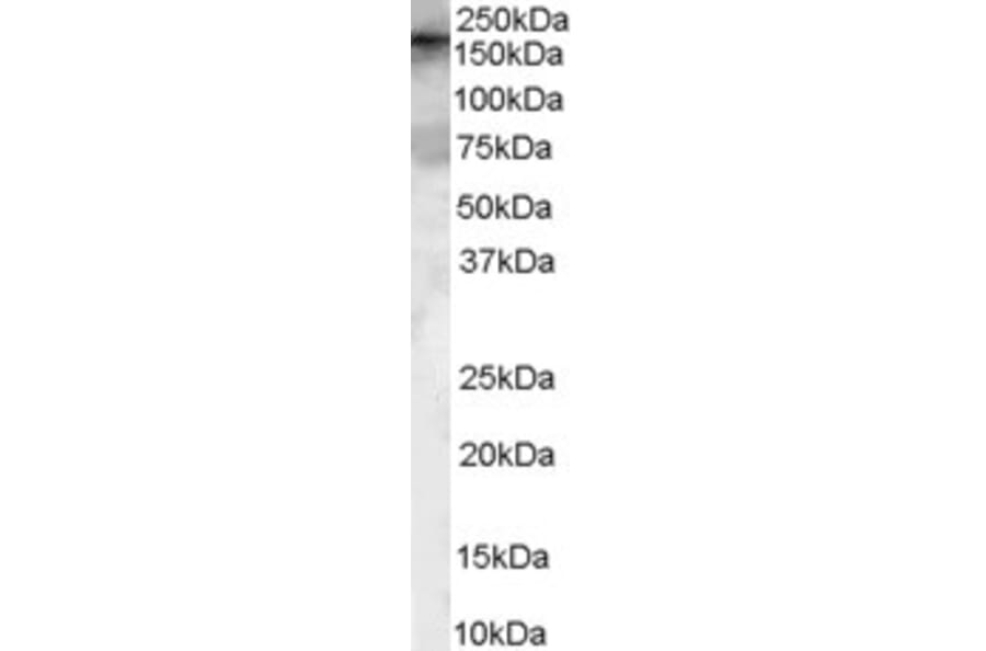 Western Blot - Anti-ARHGEF5 Antibody (A84175) - Antibodies.com