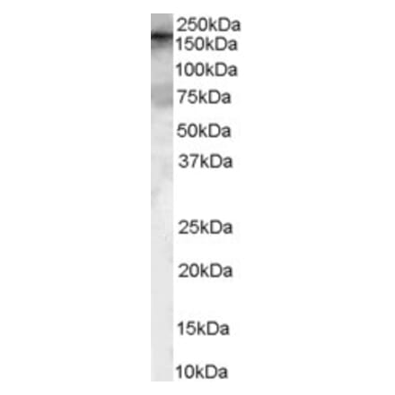 Western Blot - Anti-ARHGEF5 Antibody (A84175) - Antibodies.com