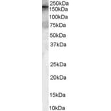 Western Blot - Anti-ARHGEF5 Antibody (A84175) - Antibodies.com