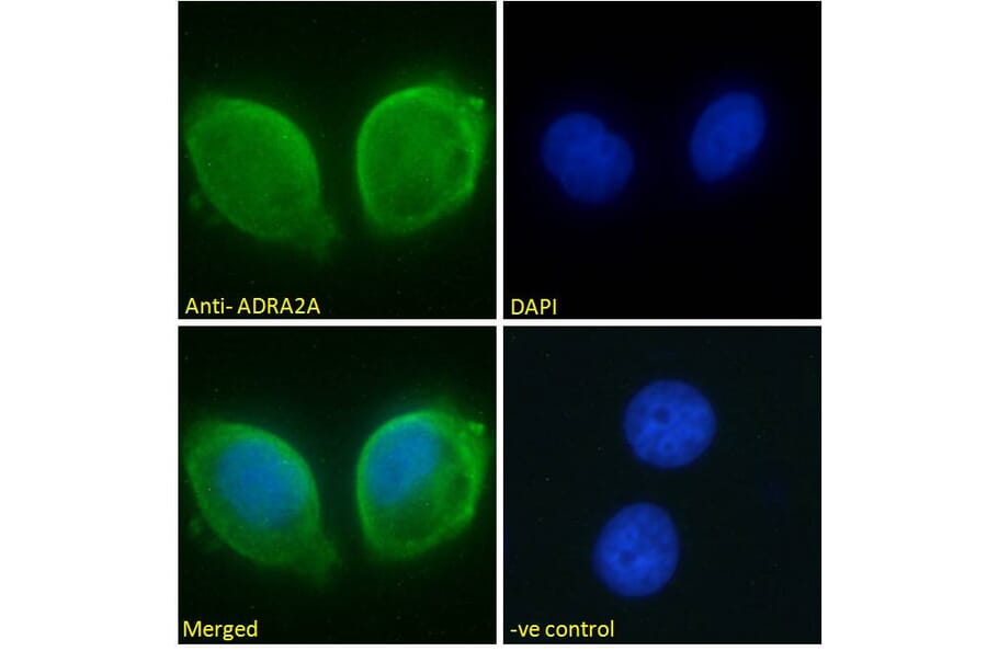 Immunofluorescence - Anti-ADRA2A Antibody (A84177) - Antibodies.com