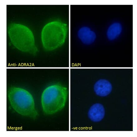 Immunofluorescence - Anti-ADRA2A Antibody (A84177) - Antibodies.com