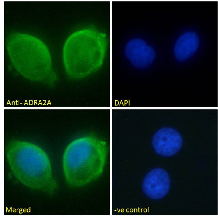 Immunofluorescence - Anti-ADRA2A Antibody (A84177) - Antibodies.com