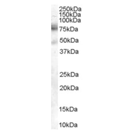 Western Blot - Anti-DCP1A Antibody (A84179) - Antibodies.com